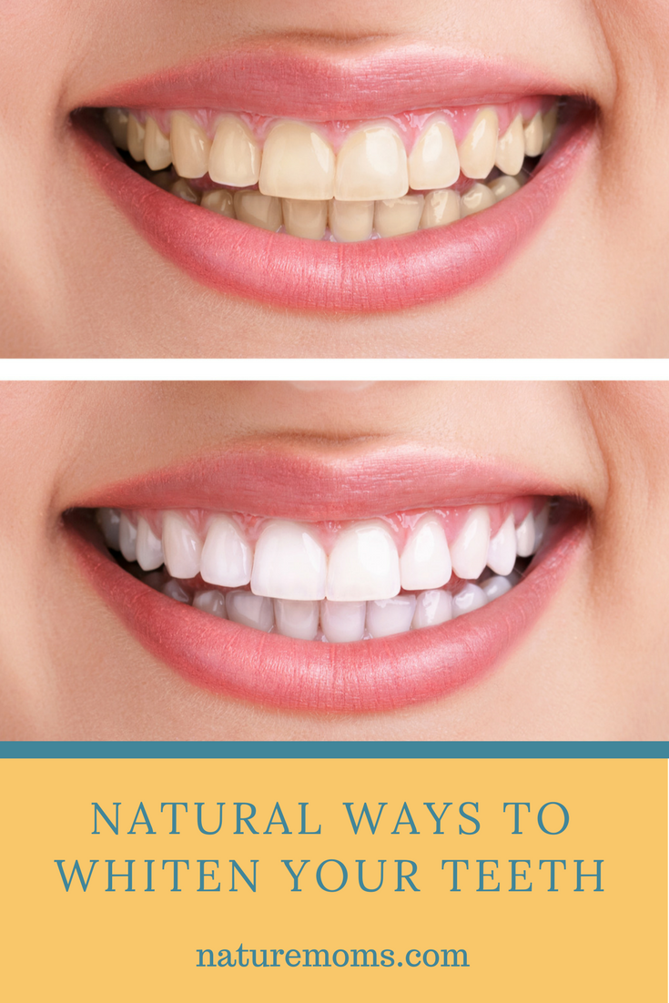 how to whiten your teeth at home